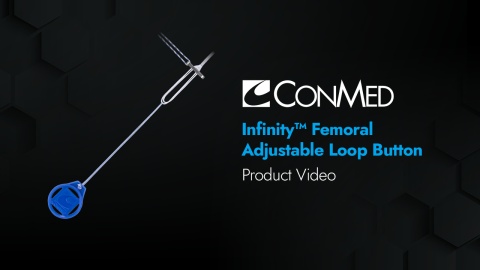Infinity™ Femoral Adjustable Loop Button - Product Video