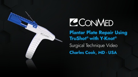 Plantar Plate Repair Using TruShot® with Y-Knot® - Charles Cook, MD