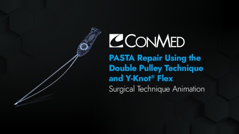 PASTA Repair Using the Double Pulley Technique and Y-Knot® Flex