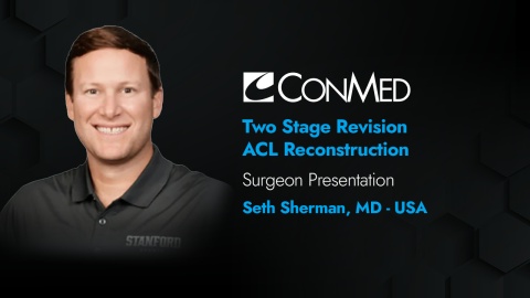 Dr. Sherman Presentation (2019) - Two Stage Revision ACL Reconstruction