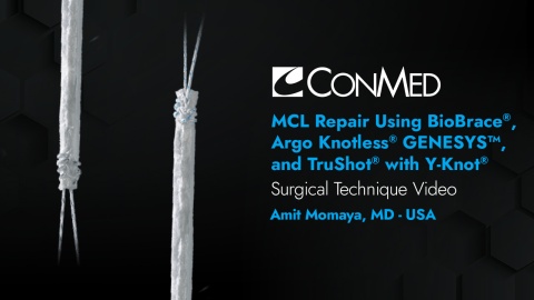 Dr. Momaya - MCL Repair Using BioBrace®, Argo Knotless® GENESYS™  and TruShot® with Y-Knot®