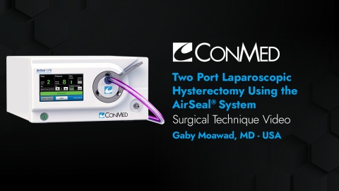 Dr. Moawad - Two-Port Laparoscopic Hysterectomy Using the AirSeal® System