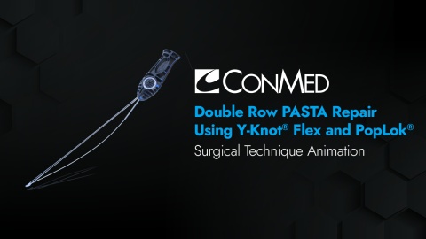Double Row PASTA Repair Using Y-Knot® Flex and PopLok®