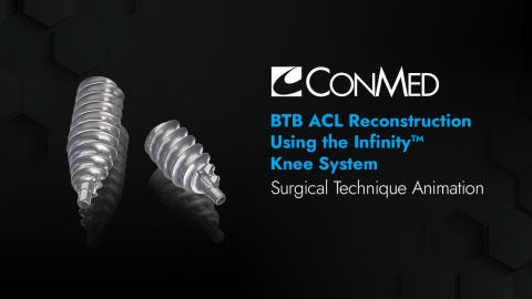 BTB ACL Reconstruction Using the Infinity™ Knee System
