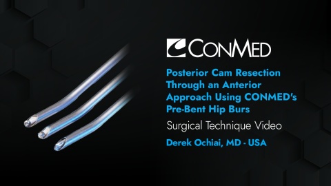 Dr. Ochiai - Posterior Cam Resection Through an Anterior Approach Using CONMED's Pre-Bent Hip Burs