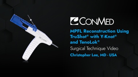 Dr. Lee - MPFL Reconstruction Using TruShot® with Y-Knot® and TenoLok®