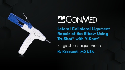 Dr. Kobayashi - Lateral Collateral Ligament Repair of the Elbow Using TruShot® with Y-Knot®