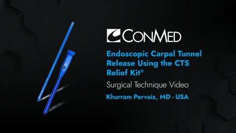Dr. Pervaiz - Endoscopic Carpal Tunnel Release Using the CTS Relief Kit®