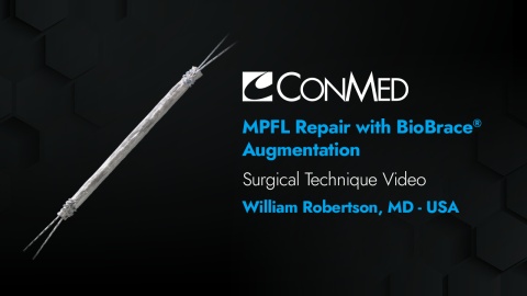 Dr. Robertson - MPFL Repair Using BioBrace® Augmentation