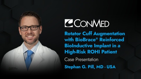Dr. Pill Presentation (2025) - Rotator Cuff Augmentation with BioBrace® Implant in a High-Risk ROHI Patient