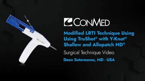 Dr. Sotereanos - Modified LRTI Technique Using TruShot® with Y-Knot® Shallow and Allopatch HD®