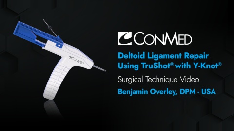 Deltoid Ligament Repair Using TruShot® with Y-Knot® - Benjamin Overley, DPM