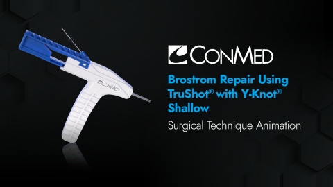 Brostrom Repair Using TruShot® with Y-Knot® Shallow