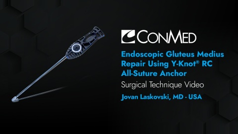 Dr. Laskovski - Endoscopic Gluteus Medius Repair Using Y-Knot® RC