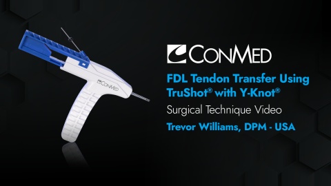 FDL Tendon Transfer Using TruShot® with Y-Knot® - Trevor Williams, DPM