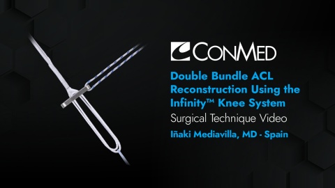 Dr. Mediavilla - Double Bundle ACL Reconstruction Using the Infinity™ Knee System
