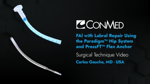 Dr. Guanche - FAI with Labral Repair Using the Paradigm® Hip System and PressFT™ Flex Anchor