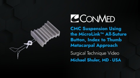 Dr. Shuler - CMC Suspension Using the MicroLink™ All-Suture Button, Index to Thumb Metacarpal Approach