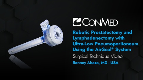 Dr. Abaza - Robotic Prostatectomy and Lymphadenectomy with Ultra-low Pneumoperitoneum Using AirSeal®