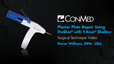 Plantar Plate Repair Using TruShot® with Y-Knot® Shallow - Trevor Williams, DPM
