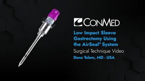 Dr. Telem - Sleeve Gastrectomy Using the AirSeal® System