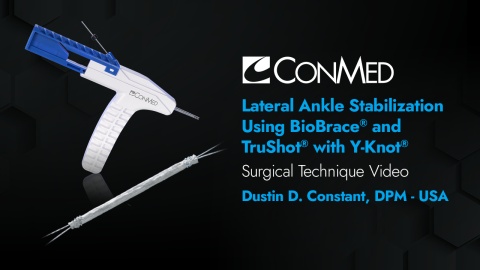 Lateral Ankle Stabilization Using BioBrace® and TruShot® - Dustin D. Constant, DPM