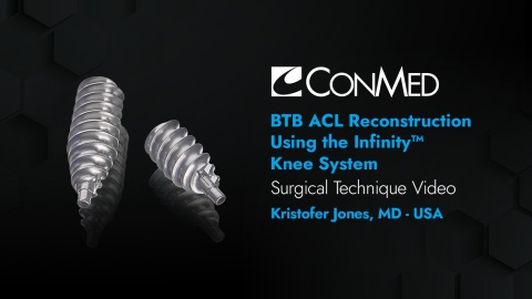 Dr. Jones - BTB ACL Reconstruction Using the Infinity™ Knee System