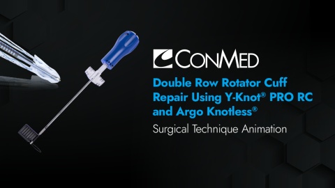 CuffLink™ Double Row Rotator Cuff Repair Using Y-Knot® PRO RC and Argo Knotless®