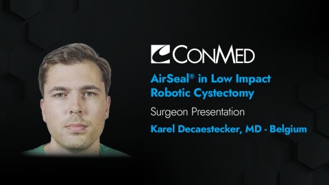 Dr. Decaestecker Presentation (2020) - AirSeal® in Low Impact Robotic Cystectomy