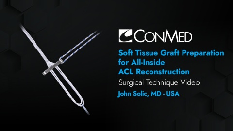 Dr. Solic - Soft Tissue Graft Preparation for All-Inside ACL Reconstruction