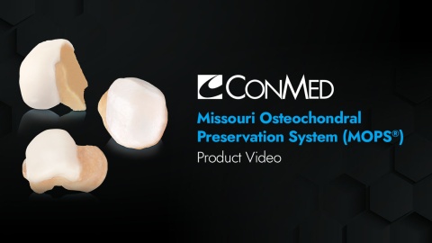 Missouri Osteochondral Preservation System (MOPS) - Product Video