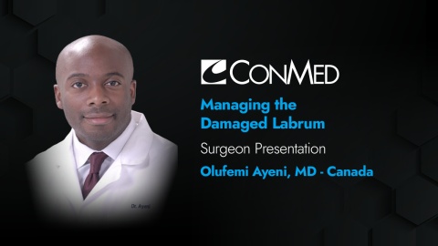 Dr. Ayeni Presentation (2019) - Managing the Damaged Labrum