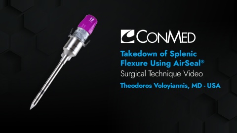 Dr. Voloyiannis - Takedown of Splenic Flexure Using AirSeal®