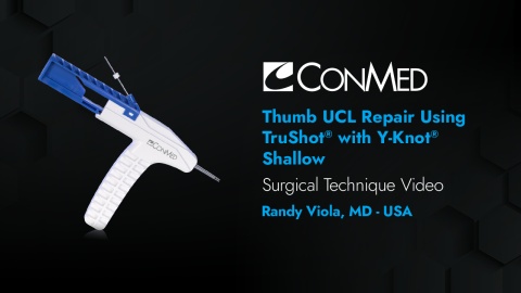 Dr. Viola - Thumb UCL Repair Using TruShot® with Y-Knot® Shallow