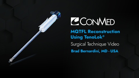 Dr. Bernardini - MQTFL Reconstruction Using TenoLok®