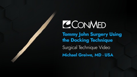 Dr. Greiwe - Tommy John Surgery Using the Docking Technique