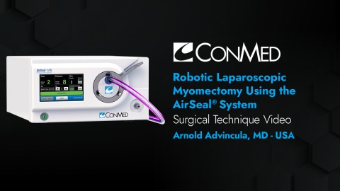 Dr. Advincula - Robot-Assisted Laparoscopic Myomectomy Using the AirSeal® System