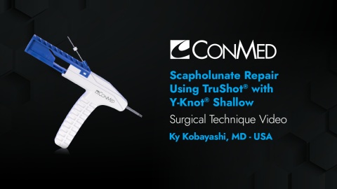 Dr. Kobayashi - Scapholunate Repair Using TruShot® with Y-Knot® Shallow