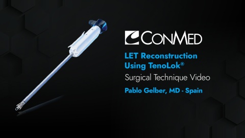 Dr. Gelber - LET Reconstruction Using TenoLok®
