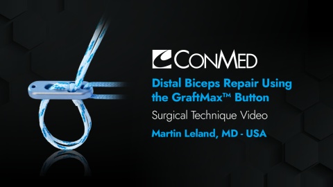 Dr. Leland - Distal Biceps Repair Using the GraftMax™ Button