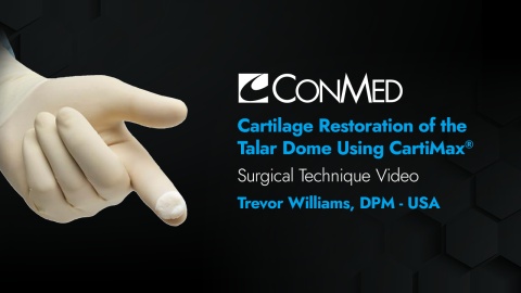Cartilage Restoration of the Talar Dome Using CartiMax® - Trevor Williams, DPM