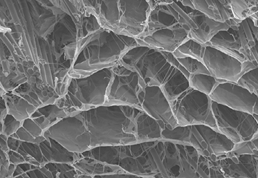 Die poröse Struktur des BioBrace<sup>®</sup> Implantats