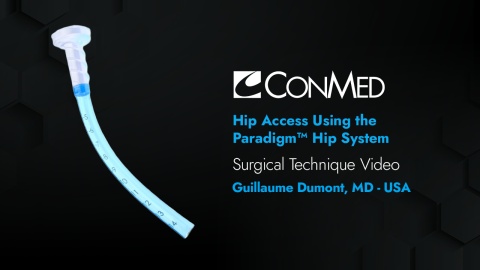 Dr. Dumont - Hip Access Using the Paradigm® System