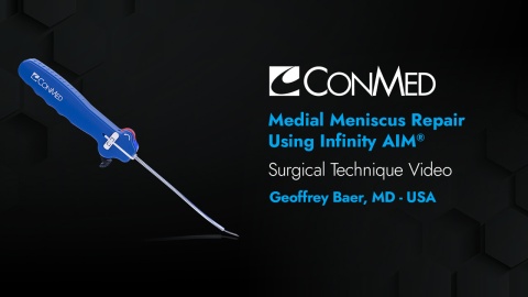 Dr. Baer - Medial Meniscus Repair Using Infinity AIM™