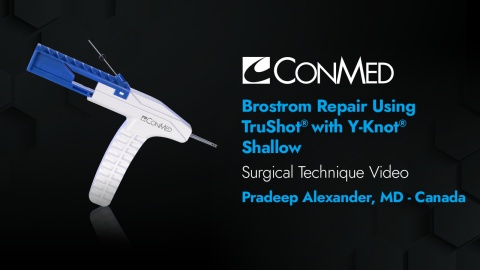 Brostrom Repair Using TruShot® with Y-Knot® Shallow - Pradeep Alexander, MD
