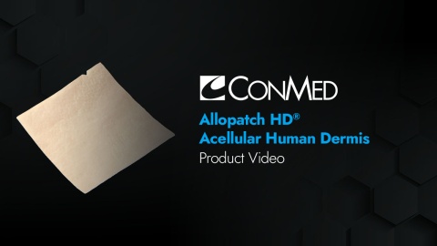 Allopatch HD® - Product Video
