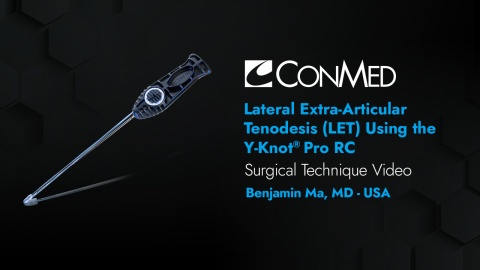 Dr. Ma - Lateral Extra-Articular Tenodesis (LET) Using Y-Knot® PRO RC
