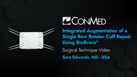 Dr. Edwards - Integrated Augmentation of a Single Row Rotator Cuff Repair using BioBrace®