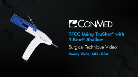 Dr. Viola - TFCC Using TruShot® with Y-Knot® Shallow