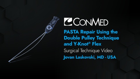 Dr. Laskovski - PASTA Repair Using the Double Pulley Technique and Y-Knot® Flex